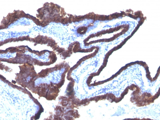 Cytokeratin 8/18 Antibody in Immunohistochemistry (Paraffin) (IHC (P))