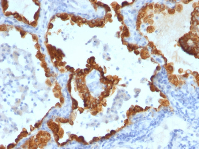 Cytokeratin 8/18 Antibody in Immunohistochemistry (Paraffin) (IHC (P))