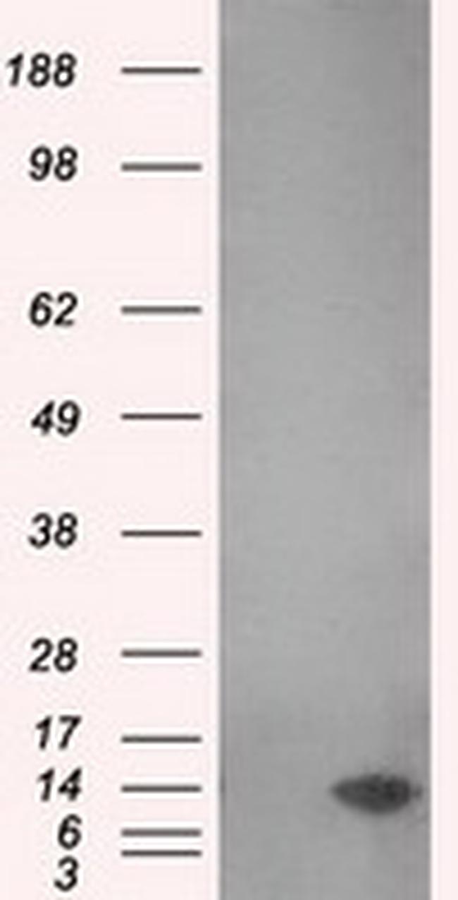 MSMB Antibody in Western Blot (WB)