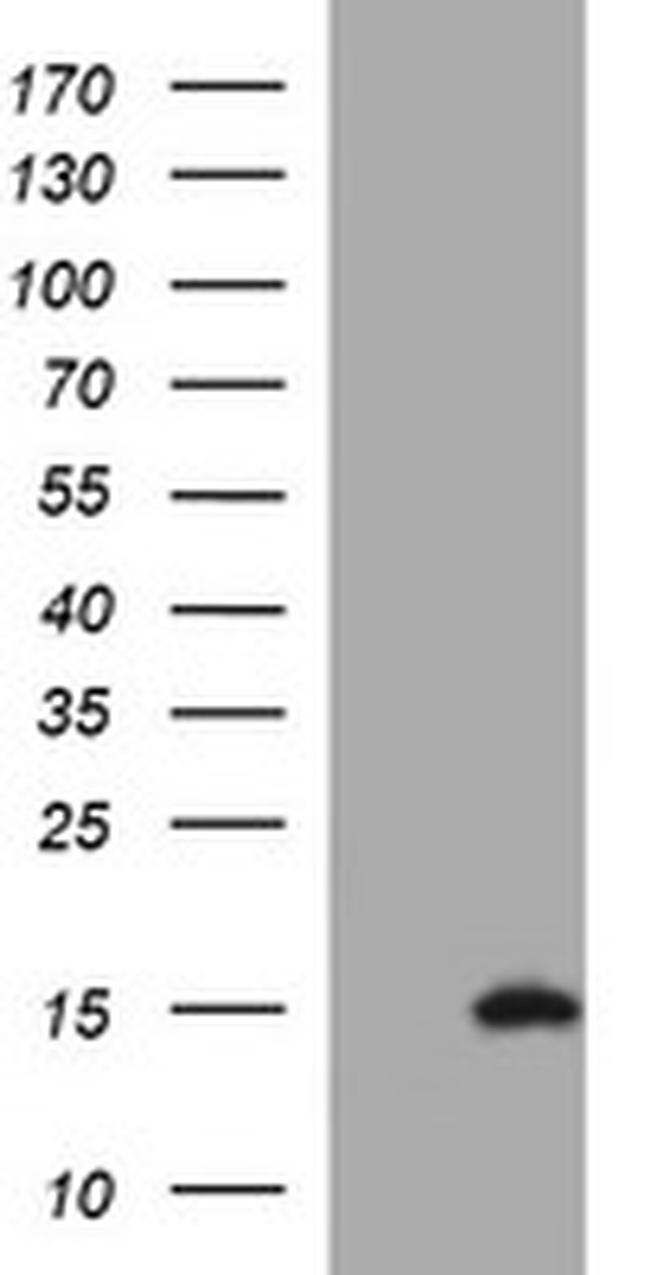 MSMB Antibody in Western Blot (WB)