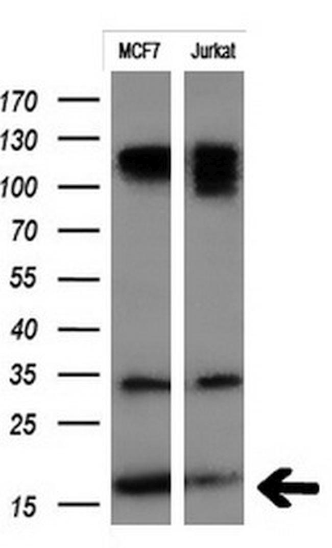 MSMB Antibody in Western Blot (WB)