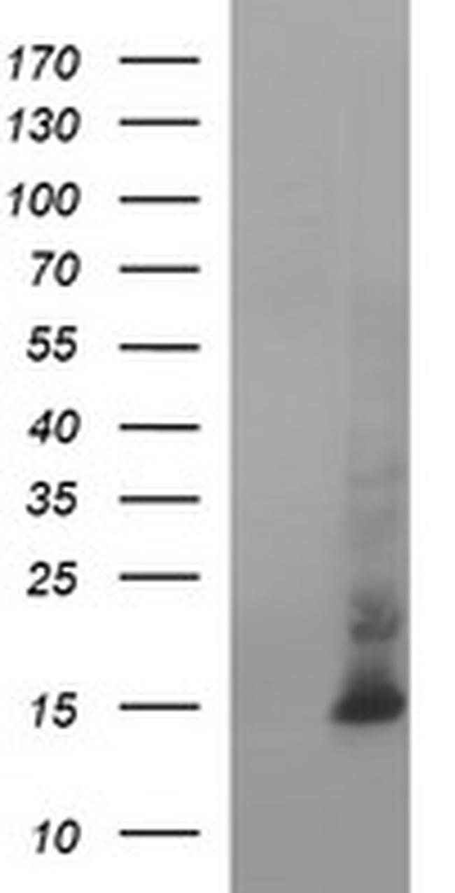 MSMB Antibody in Western Blot (WB)