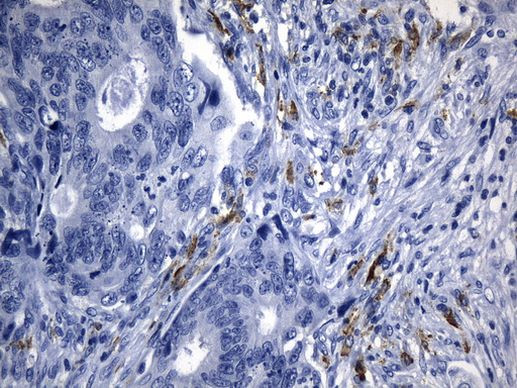 MSR1 Antibody in Immunohistochemistry (Paraffin) (IHC (P))