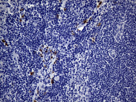 MSR1 Antibody in Immunohistochemistry (Paraffin) (IHC (P))