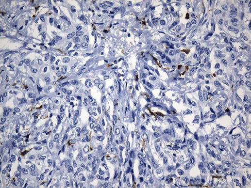 MSR1 Antibody in Immunohistochemistry (Paraffin) (IHC (P))