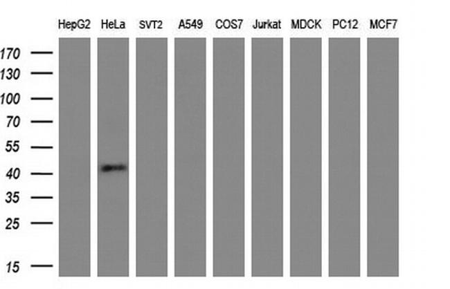 MSTN Antibody in Western Blot (WB)