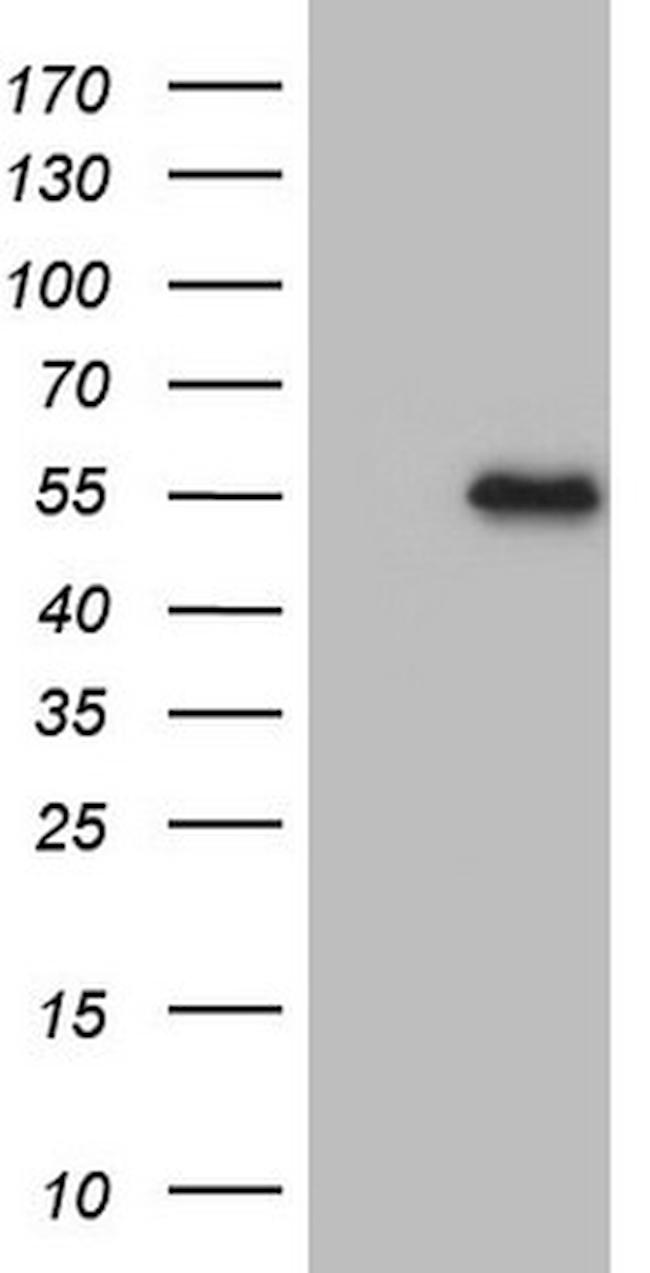 MSTN Antibody in Western Blot (WB)