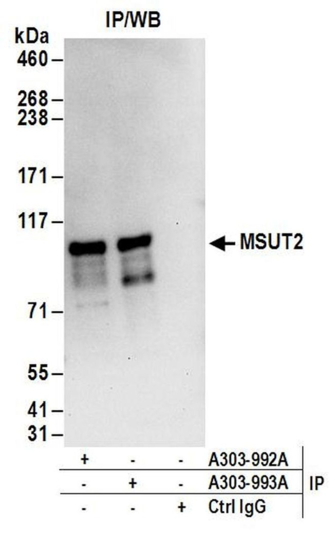 MSUT2 Antibody in Immunoprecipitation (IP)