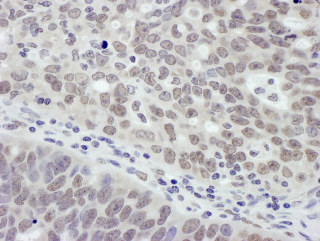 MTA1 Antibody in Immunohistochemistry (IHC)