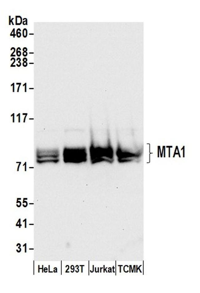 MTA1 Antibody in Western Blot (WB)