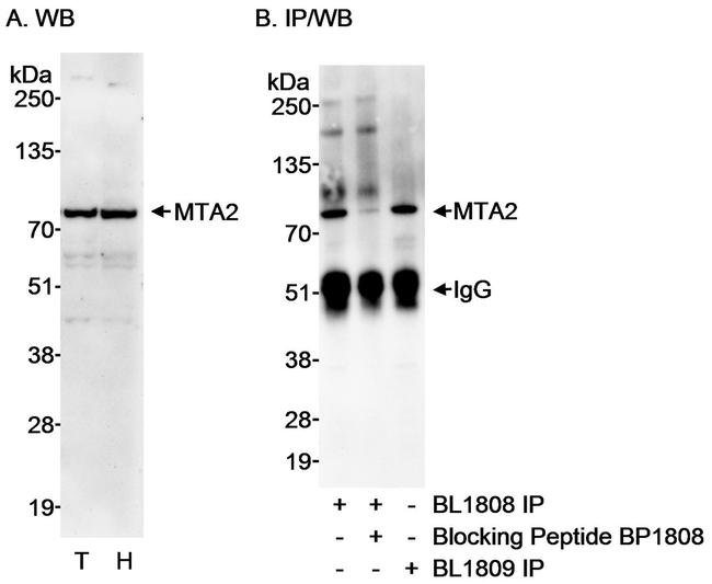 MTA2 Antibody in Western Blot (WB)