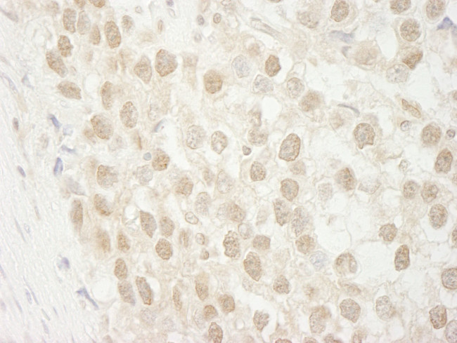 MTA3 Antibody in Immunohistochemistry (IHC)