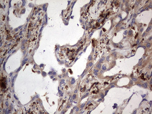 MTDH Antibody in Immunohistochemistry (Paraffin) (IHC (P))