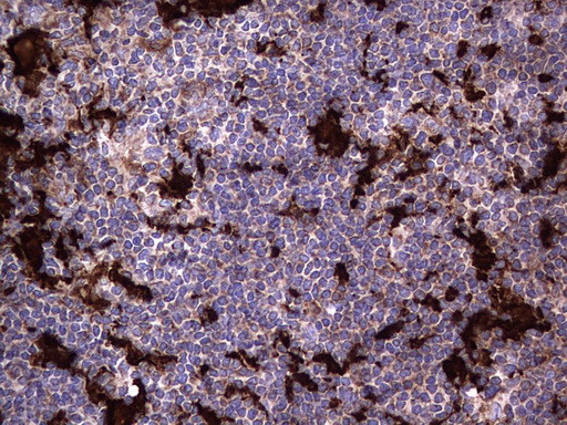 MTDH Antibody in Immunohistochemistry (Paraffin) (IHC (P))