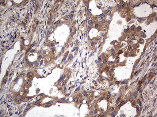 MTDH Antibody in Immunohistochemistry (Paraffin) (IHC (P))