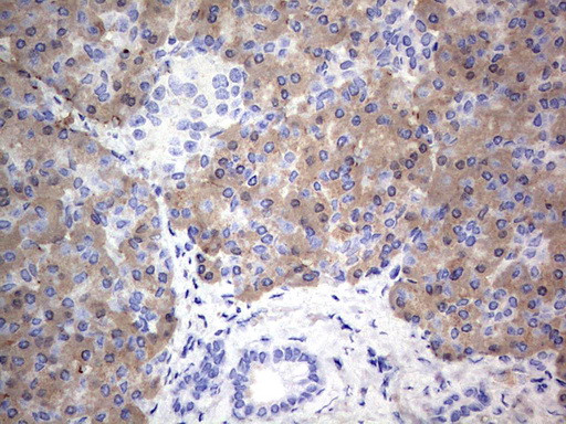 MTDH Antibody in Immunohistochemistry (Paraffin) (IHC (P))