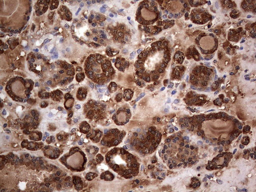 MTDH Antibody in Immunohistochemistry (Paraffin) (IHC (P))