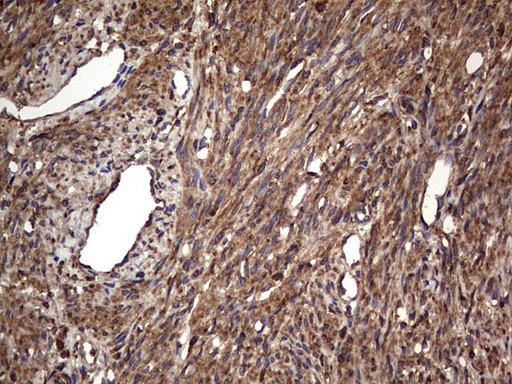 MTDH Antibody in Immunohistochemistry (Paraffin) (IHC (P))