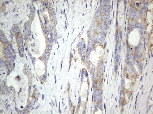 MTDH Antibody in Immunohistochemistry (Paraffin) (IHC (P))