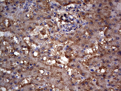 MTDH Antibody in Immunohistochemistry (Paraffin) (IHC (P))