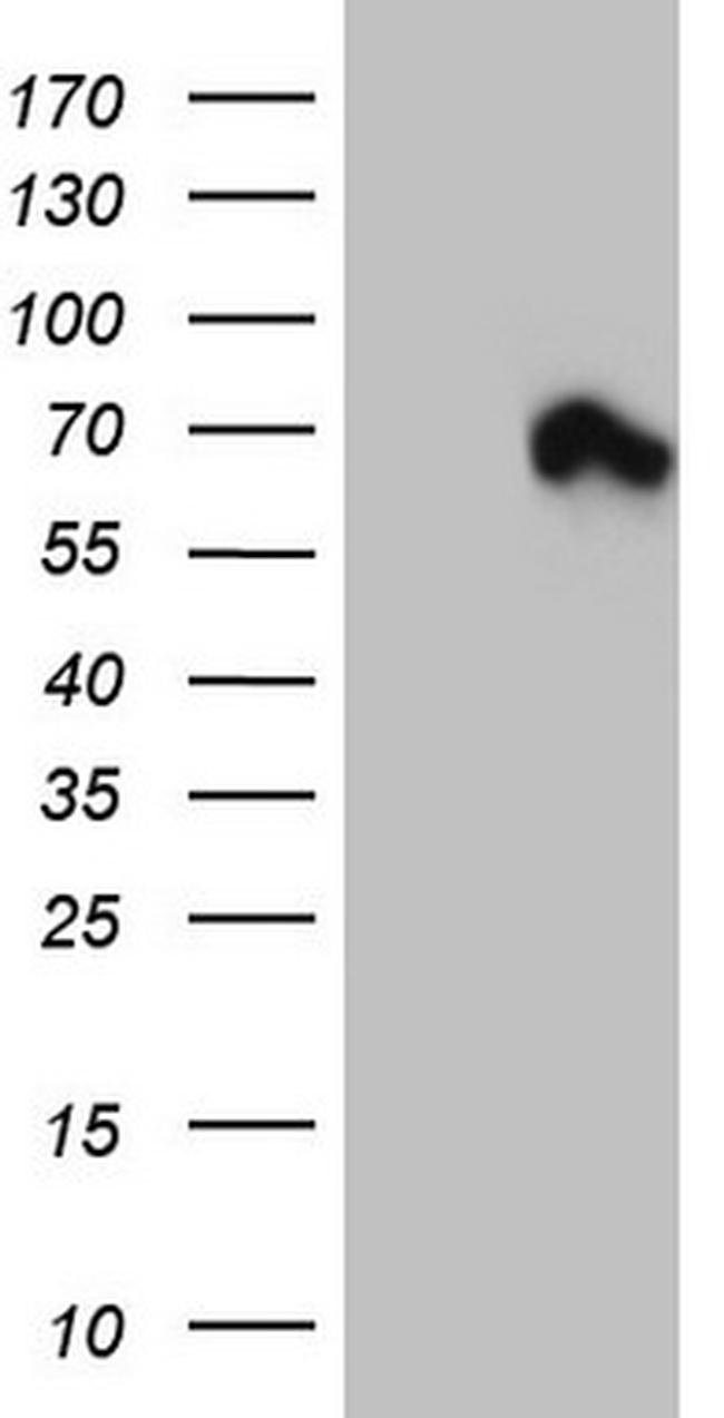 MTDH Antibody in Western Blot (WB)