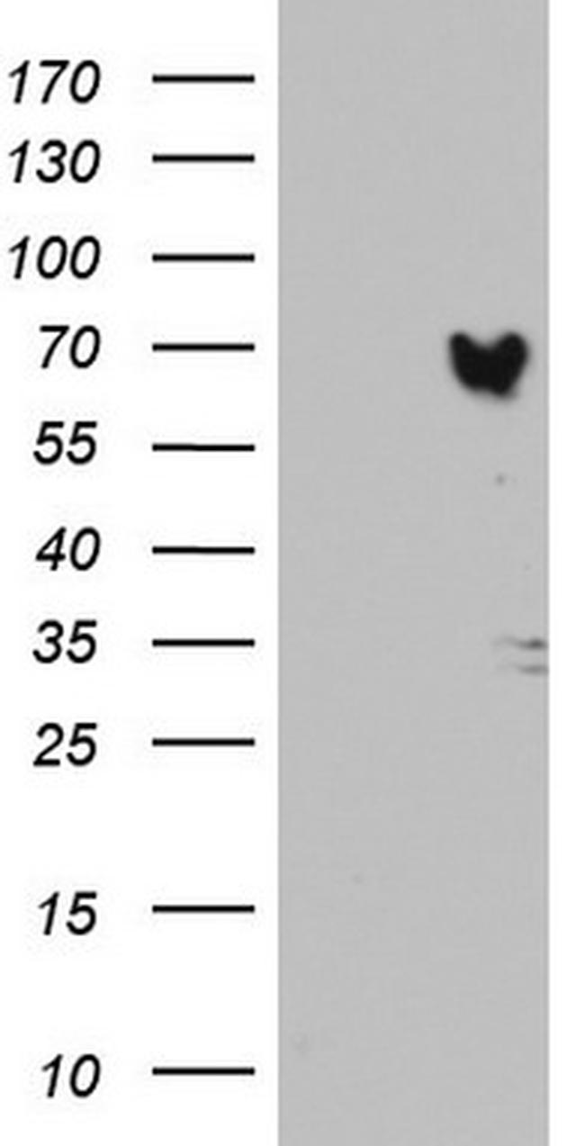 MTDH Antibody in Western Blot (WB)