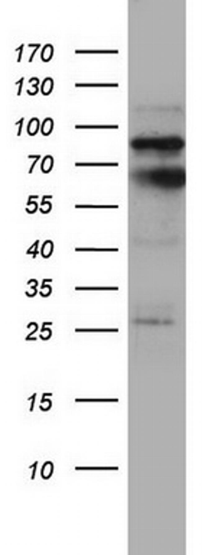 MTDH Antibody in Western Blot (WB)