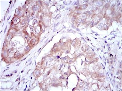 MTHFR Antibody in Immunohistochemistry (Paraffin) (IHC (P))