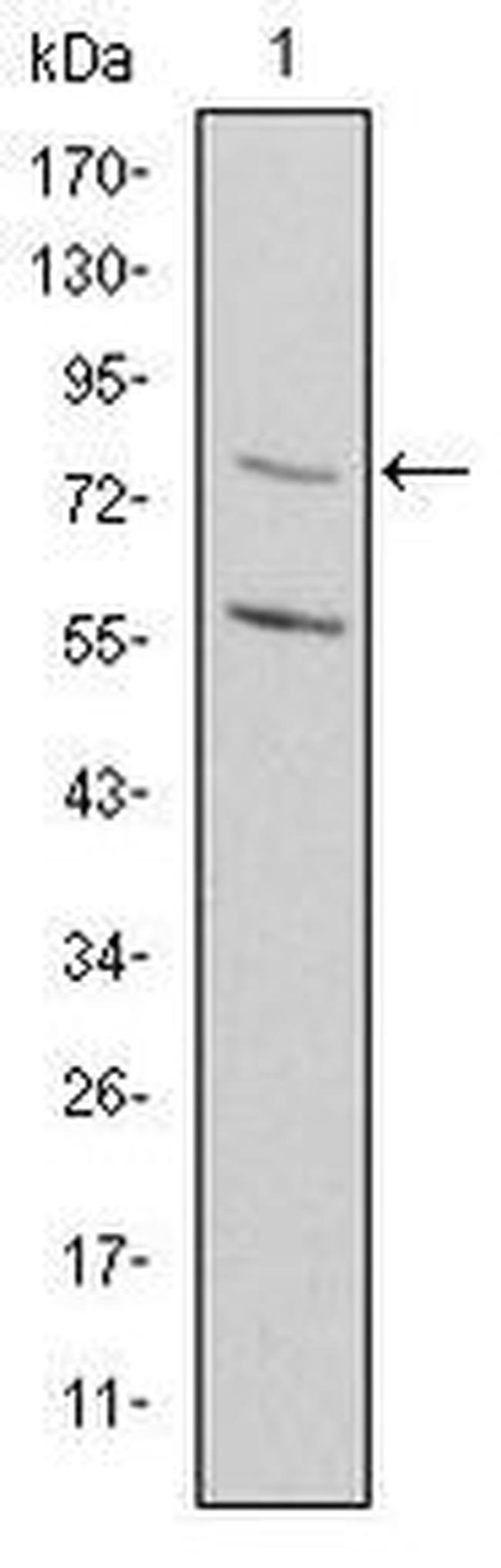 MTHFR Antibody in Western Blot (WB)