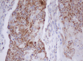 MTIF3 Antibody in Immunohistochemistry (Paraffin) (IHC (P))