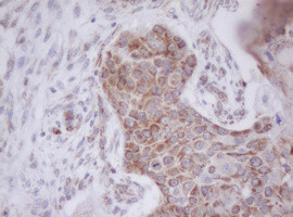 MTIF3 Antibody in Immunohistochemistry (Paraffin) (IHC (P))