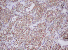 MTIF3 Antibody in Immunohistochemistry (Paraffin) (IHC (P))