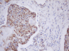 MTIF3 Antibody in Immunohistochemistry (Paraffin) (IHC (P))