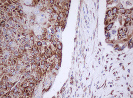 MTIF3 Antibody in Immunohistochemistry (Paraffin) (IHC (P))