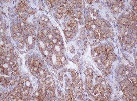 MTIF3 Antibody in Immunohistochemistry (Paraffin) (IHC (P))