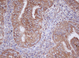 MTIF3 Antibody in Immunohistochemistry (Paraffin) (IHC (P))