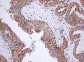 MTIF3 Antibody in Immunohistochemistry (Paraffin) (IHC (P))