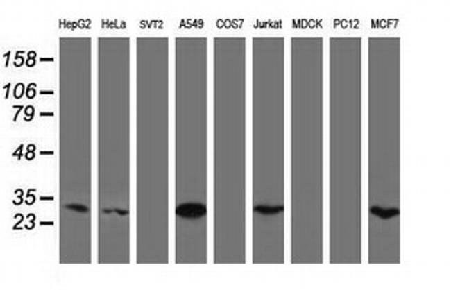 MTIF3 Antibody in Western Blot (WB)