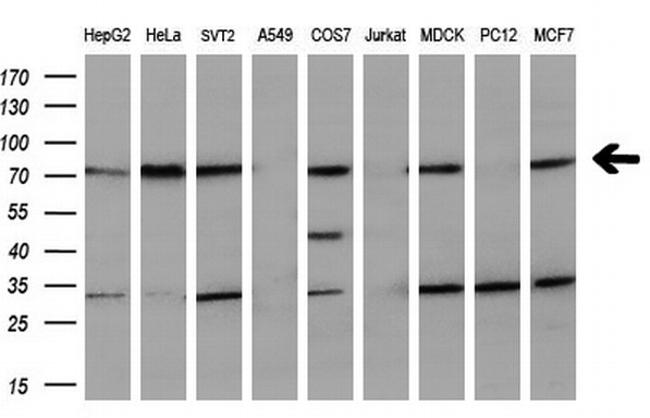 MTMR2 Antibody in Western Blot (WB)