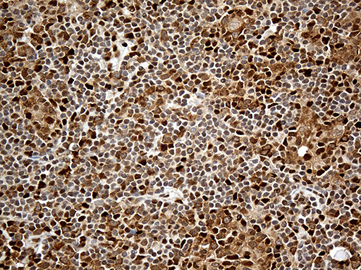 MTOR Antibody in Immunohistochemistry (Paraffin) (IHC (P))