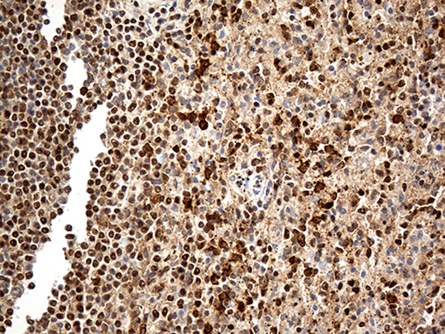 MTOR Antibody in Immunohistochemistry (Paraffin) (IHC (P))