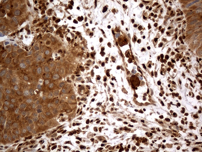 MTOR Antibody in Immunohistochemistry (Paraffin) (IHC (P))