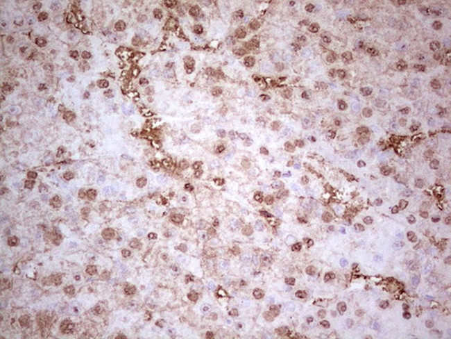 MTOR Antibody in Immunohistochemistry (Paraffin) (IHC (P))