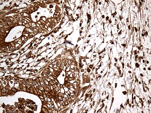 MTOR Antibody in Immunohistochemistry (Paraffin) (IHC (P))