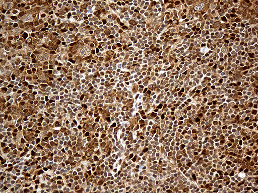 MTOR Antibody in Immunohistochemistry (Paraffin) (IHC (P))