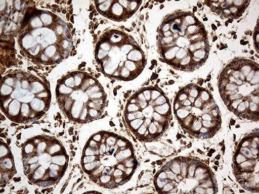 MTOR Antibody in Immunohistochemistry (Paraffin) (IHC (P))