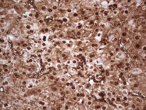 MTOR Antibody in Immunohistochemistry (Paraffin) (IHC (P))