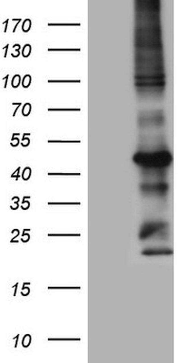 MTOR Antibody in Western Blot (WB)