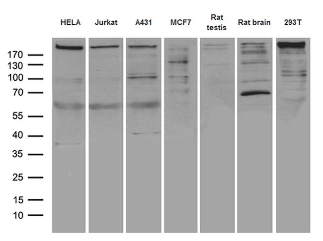 MTOR Antibody in Western Blot (WB)