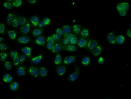 MTRF1L Antibody in Immunocytochemistry (ICC/IF)